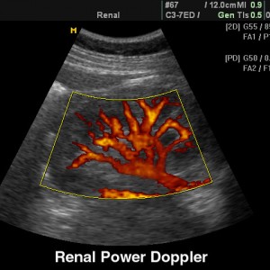 image doppler renale